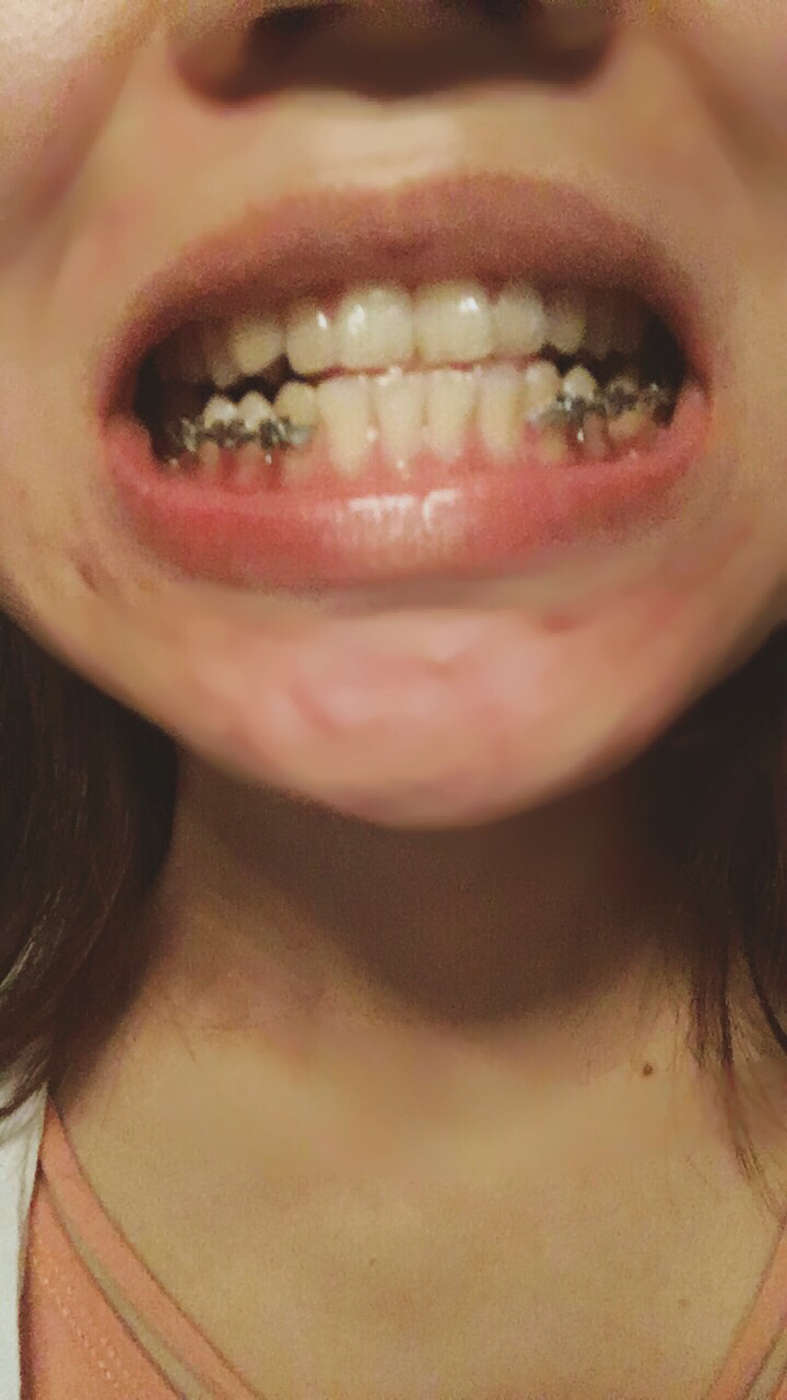 好用的日志軟件_打印準位號圖用軟件好_用同花順用里面的什么軟件好