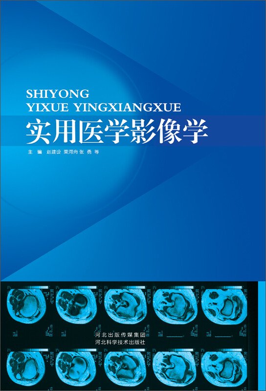影像醫(yī)學(xué)是屬于什么醫(yī)學(xué)_好用的醫(yī)學(xué)影像軟件_影像醫(yī)學(xué)專業(yè)