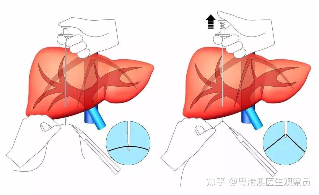 電腦上怎么輸入大于號_大于輸入電腦號上怎么輸入_大于號電腦怎么輸入
